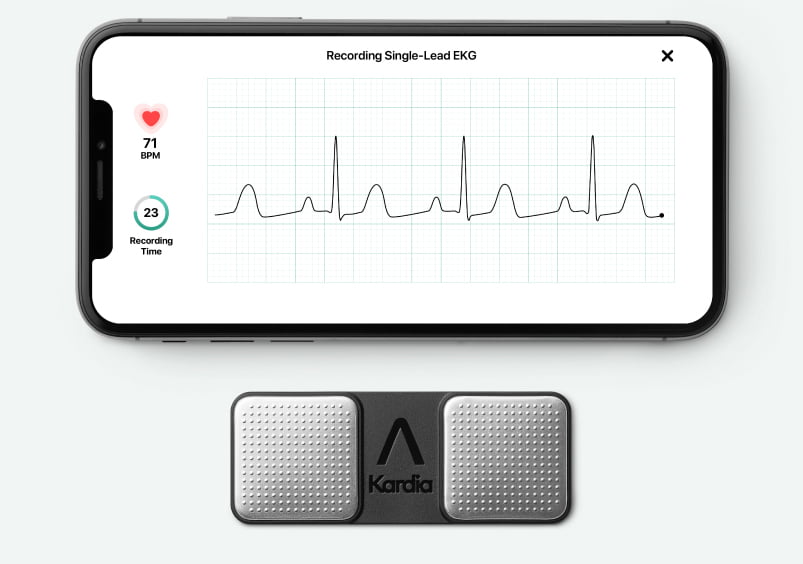 KardiaMobile with iPhone showing ECG